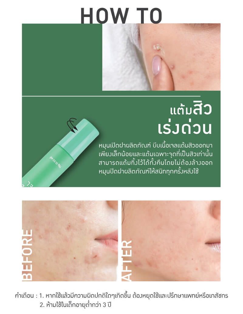 Baby Bright Clear Acne Gel