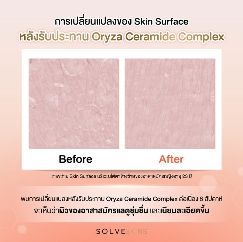 Solve Skin Daily Collagen Dipeptide Plus Ceramide Peach Flavor - Image 5