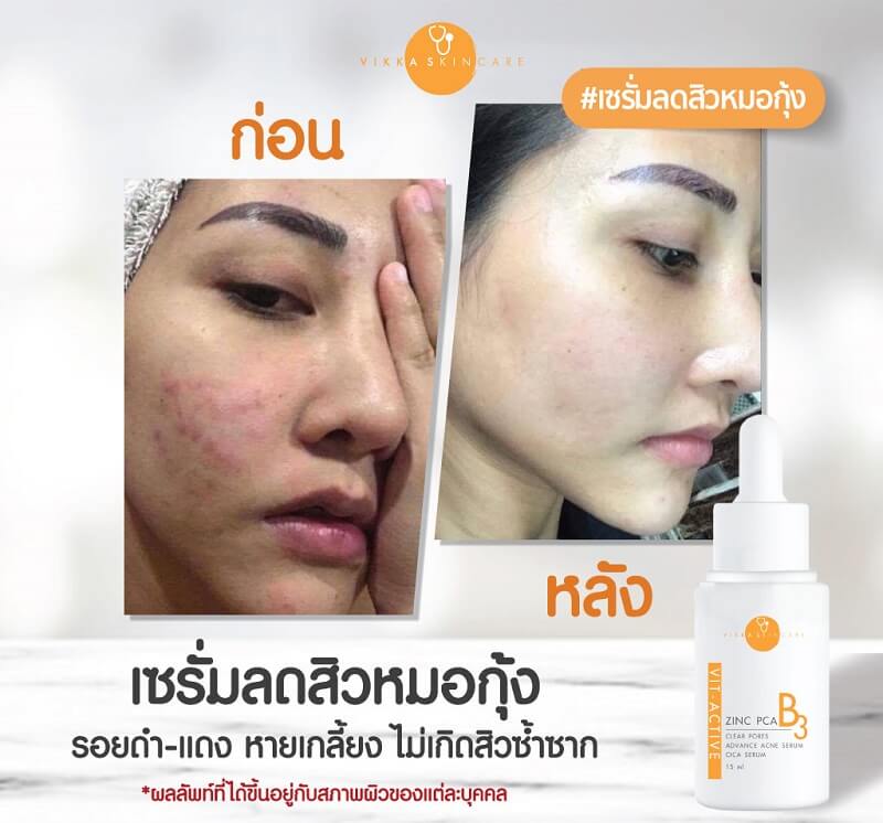 Vikka Skincare Vit-active B3