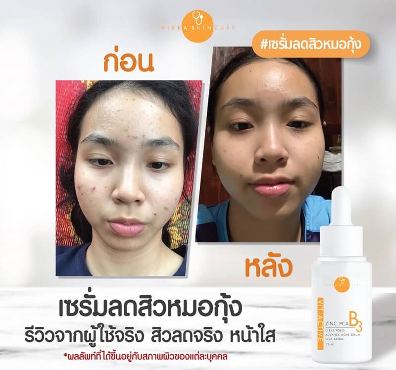 Vikka Skincare Vit-active B3 Serum - Image 7
