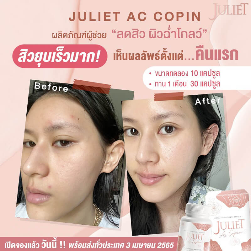 Juliet Ac Copin
