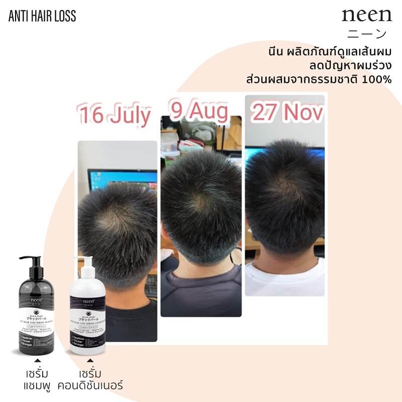 neen Black Pearl Anti Hair Loss Serum Conditioner - Image 6