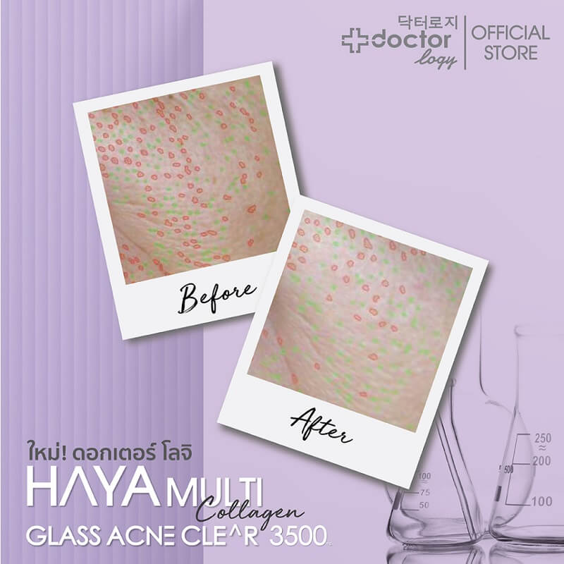Doctorlogy Haya Multi Collagen Glass Acne Clear 3500 mg - Image 7