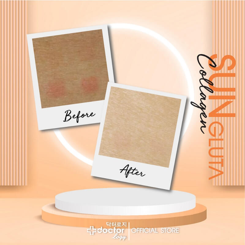 Doctorlogy Sun Gluta Collagen