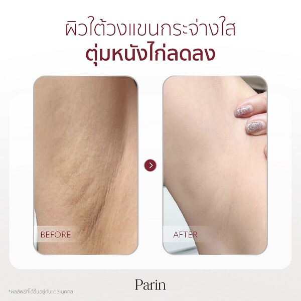 Parin Perfect White Underarm Cream - Image 12