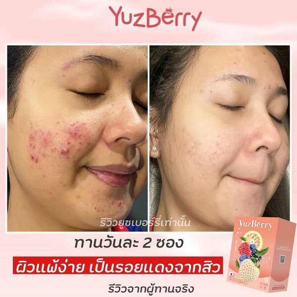 YuzBerry Hya Cha - Image 12