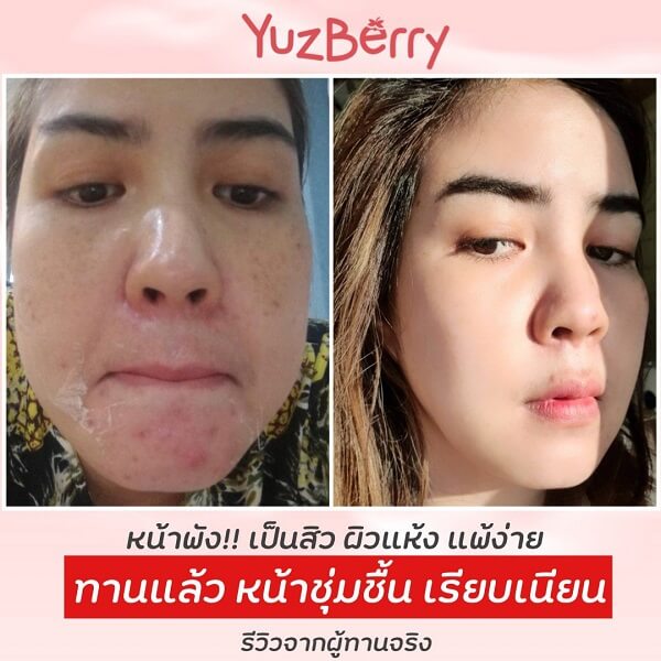 YuzBerry Hya Cha - Image 13