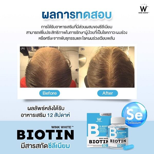 Wink White Gluta (Buy 1 get 1 free) - Image 11