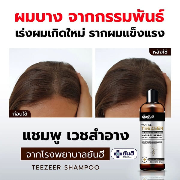 Yanhee Teezeer Anti Hair Fall Control Shampoo