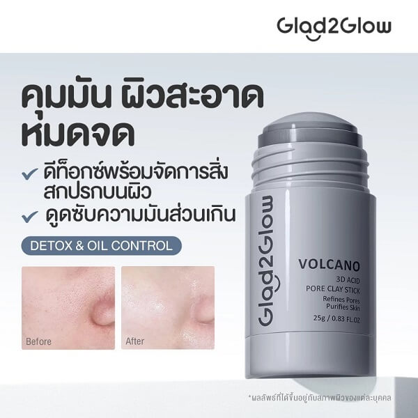 Glad2Glow Volcano 3D Acid Pore Clay Stick - Image 4