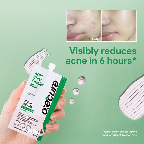 OxeCure Acne Clear Powder Mud - Image 12