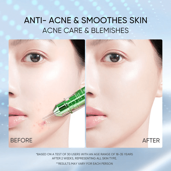 Skintific 3X Acid Intensive Acne Spot - Image 9