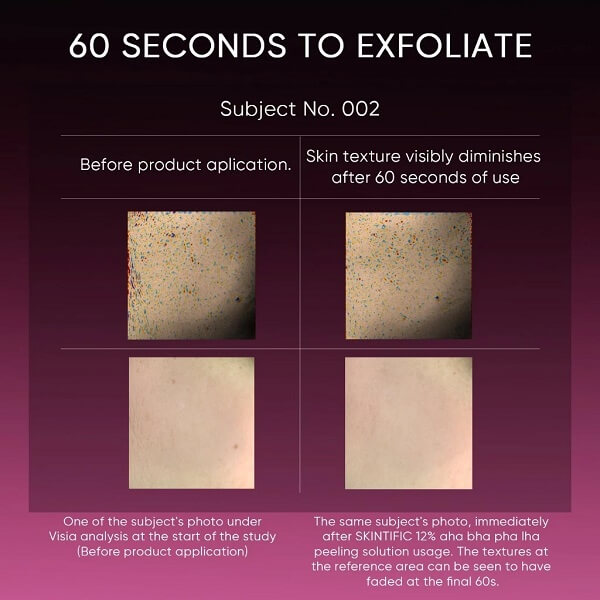 Skintific AHA BHA PHA LHA Peeling Solution - Image 8
