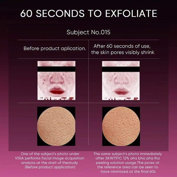 Skintific AHA BHA PHA LHA Peeling Solution - Image 9