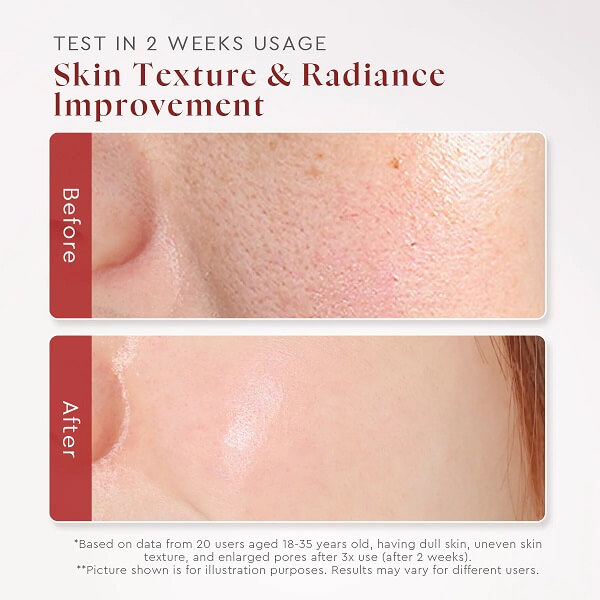 Glad2Glow AHA BHA PHA Intensive Peeling Solution - Image 9