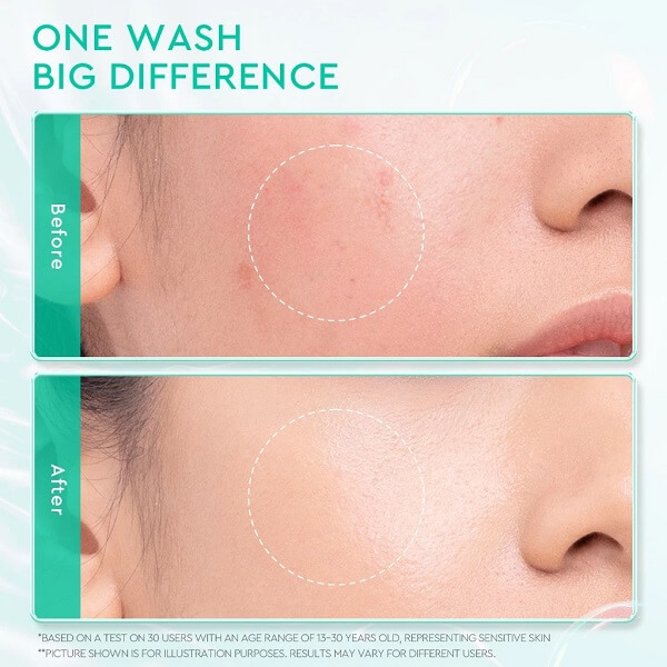 Glad2Glow Low Ph 5.5 Gentle Facial Wash - Image 7