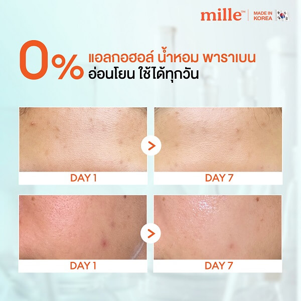 Mille Acne Power Shot Intensive Serum - Image 10